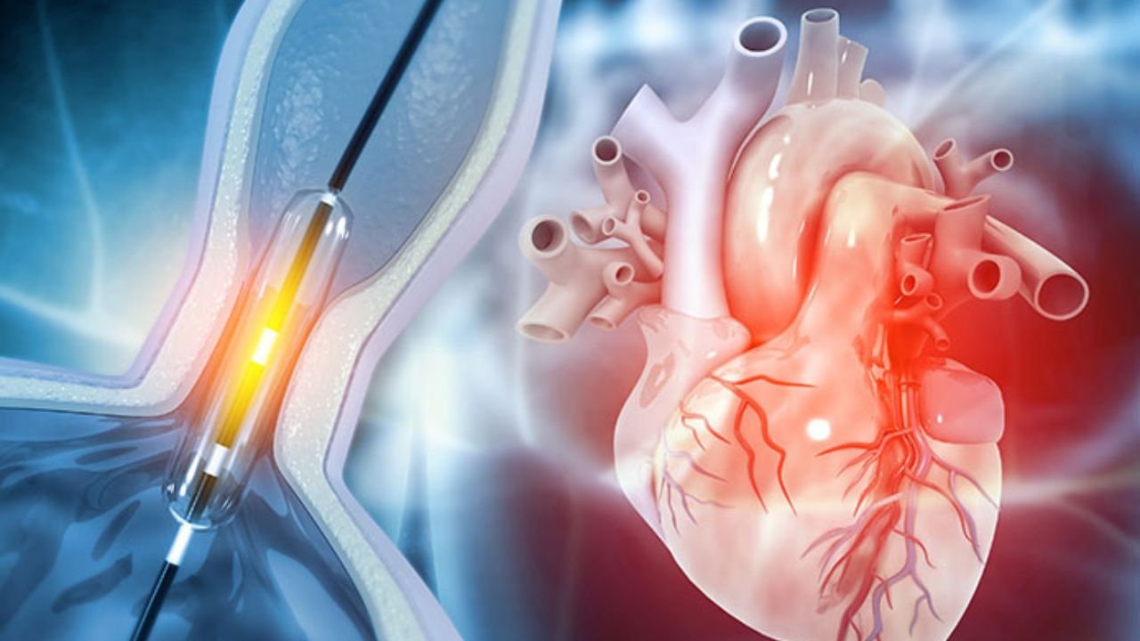 Anti-clotting drugs: Not as good as angioplasty?